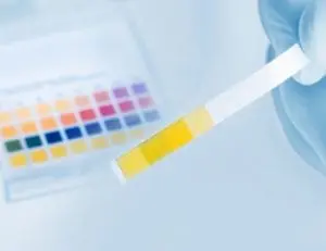 Alkalinity Control