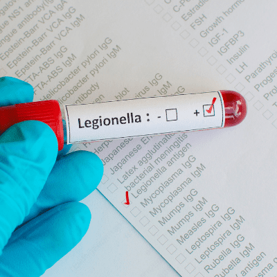 Legionella Treatment